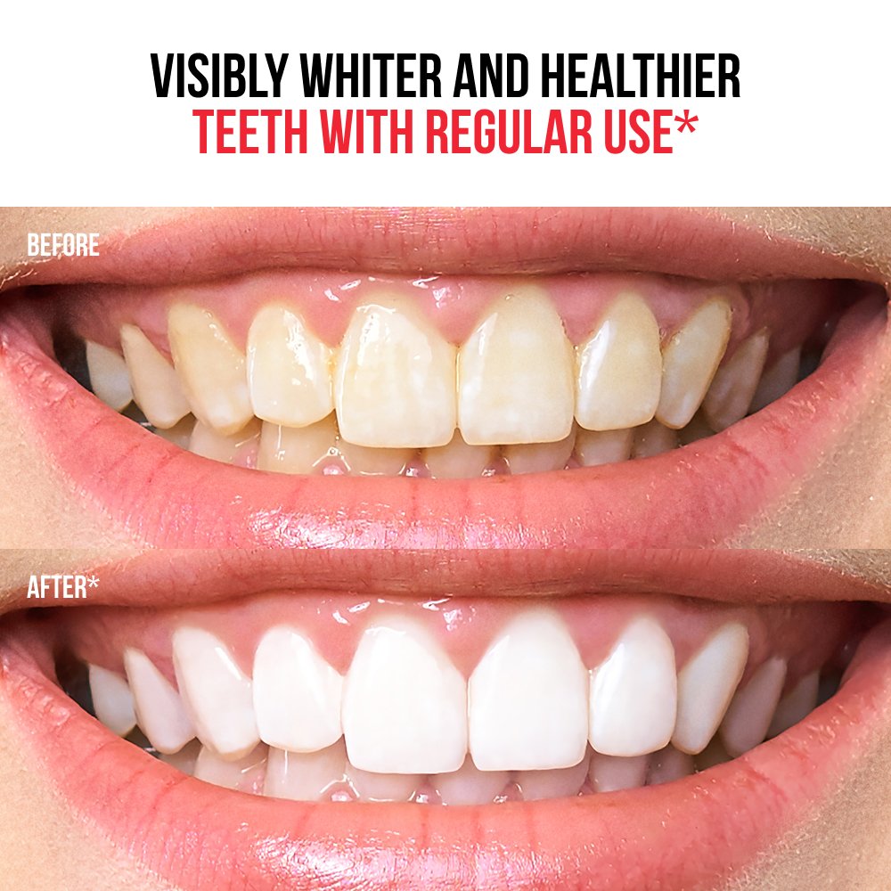 Regenerative toothpaste 6-in-1